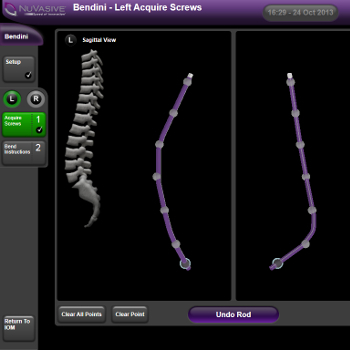 Spinal Rod-Bending Software for Surgical Planning | NOVO
